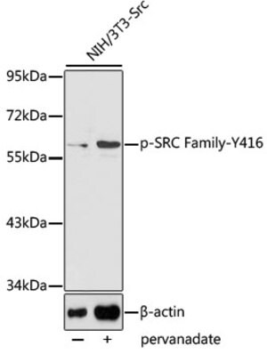 MILLIPLEX® 2-Plex Phospho/Total P38 - Cell Signaling Multiplex Assay ...