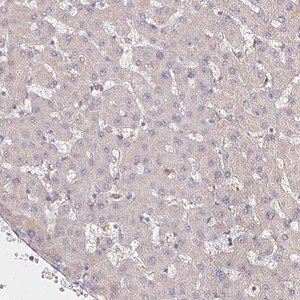 Anti-PNPLA3 antibody produced in rabbit Prestige Antibodies&#174; Powered by Atlas Antibodies, affinity isolated antibody, buffered aqueous glycerol solution