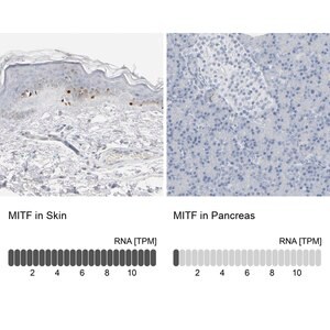 Anti Mitf Antibody Produced In Rabbit Prestige Antibodies Powered By Atlas Antibodies Affinity Isolated Antibody