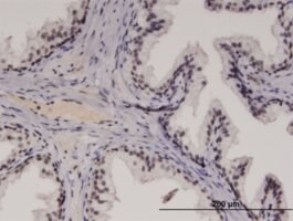 Monoclonal Anti Recql4 Antibody Produced In Mouse Clone 2g8 Purified Immunoglobulin Buffered Aqueous Solution